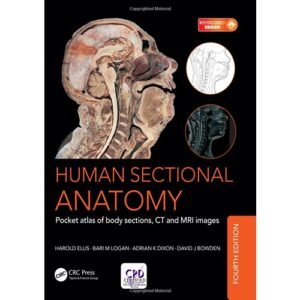 Human Sectional Anatomy: Pocket atlas of body sections, CT and MRI images, Fourth edition Paperback